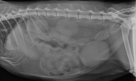 radiologia-digital-radiografia-abdomen